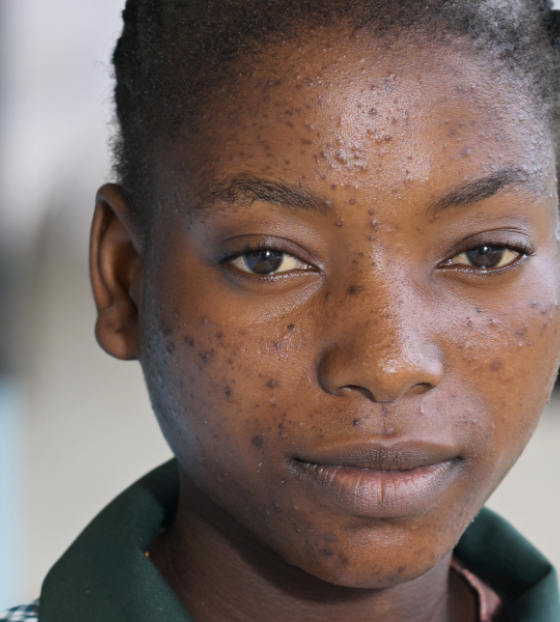 School girl in Zambia